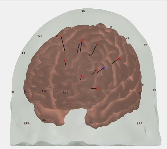 3D rendering showing locations of sources and detectors on the brain