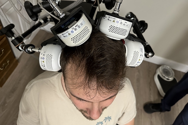Therapeutic laser device on subject&#039;s head