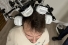 Therapeutic laser device on subject's head
